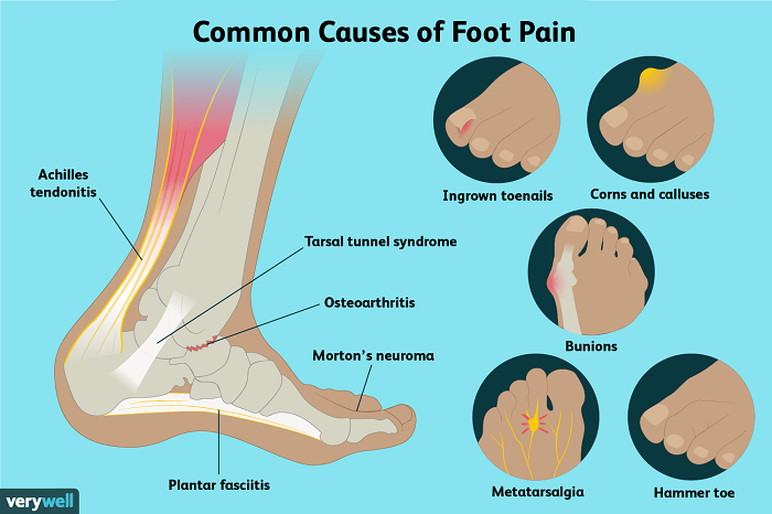 Understanding Foot Health